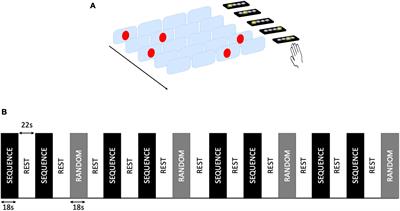 Changes in brain perfusion with training-related visuomotor improvement in MS